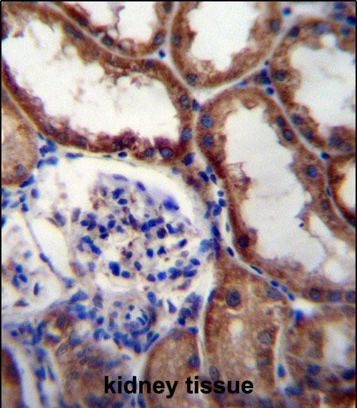 WNT16 Antibody (C-term) (Cat