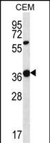 WNT16 Antibody (C-term) western blot analysis in CEM cell line lysates (35ug/lane)