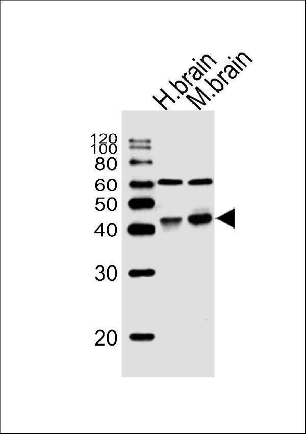 Western blot analysis of lysates from human brain, mouse brain tissue (from left to right), using WNT16 Antibody (C-term) (Cat