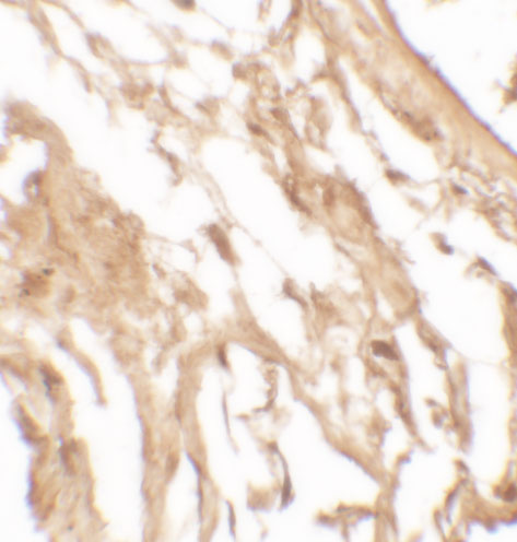 a03607 1 il37 primary antibodies ihc testing 2