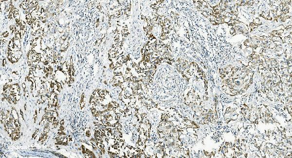 a03607 3 il37 primary antibodies ihc testing 1