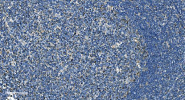 a03607 3 il37 primary antibodies ihc testing 2_1