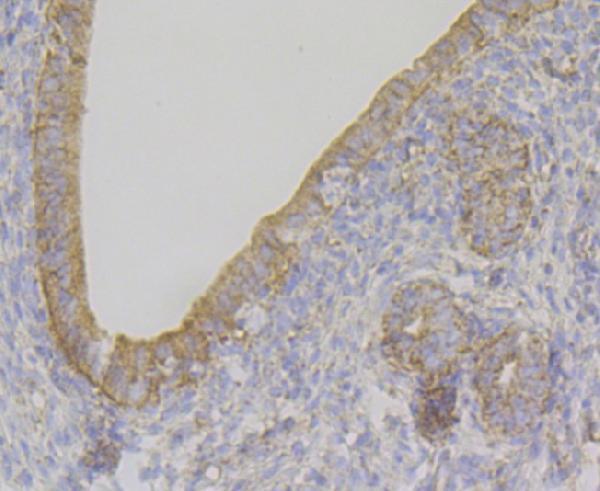 a03608 1 ndufs4 primary antiboties ihc testing 2