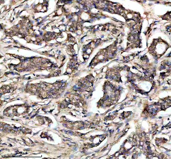 a03608 3 ndufs4 primary antibodies ihc testing 1