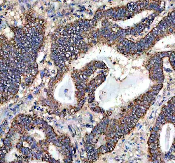 a03608 3 ndufs4 primary antibodies ihc testing 4