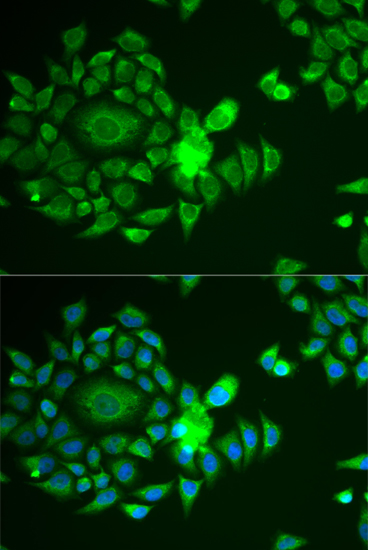 a03608 ndufs4 primary antiboties if testing 3