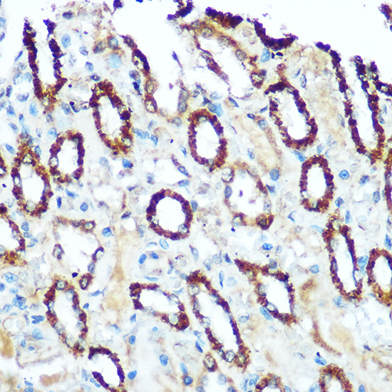 a03608 ndufs4 primary antiboties ihc testing 2