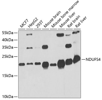 a03608 ndufs4 primary antiboties wb testing 1