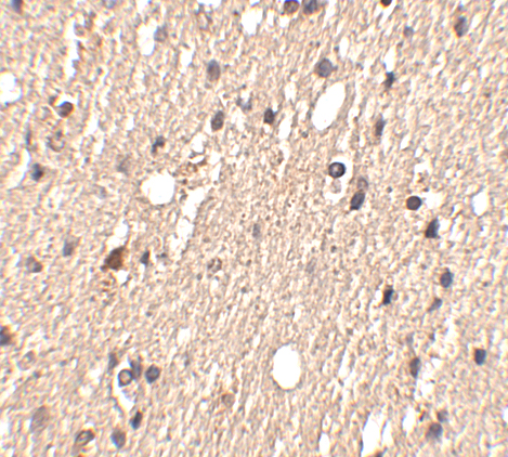 a03613 spred1 primary antibodies ihc testing 2