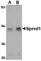 a03613 spred1 primary antibodies wb testing 1