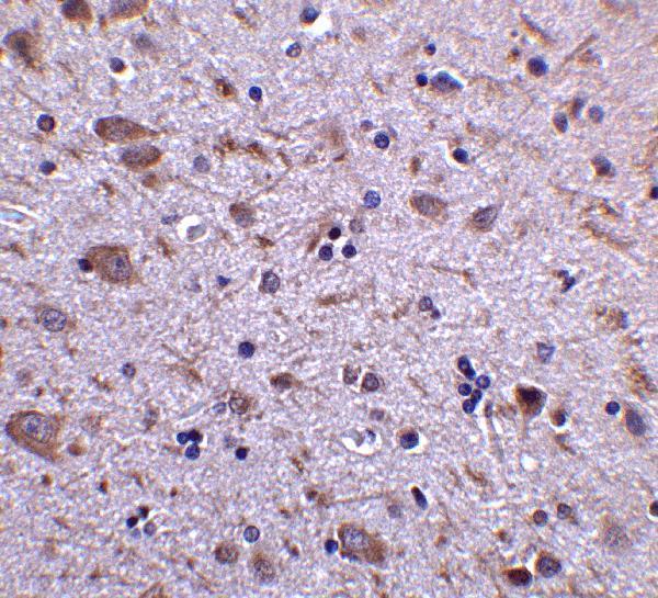 a03614 irgm primary antibodies ihc testing 2