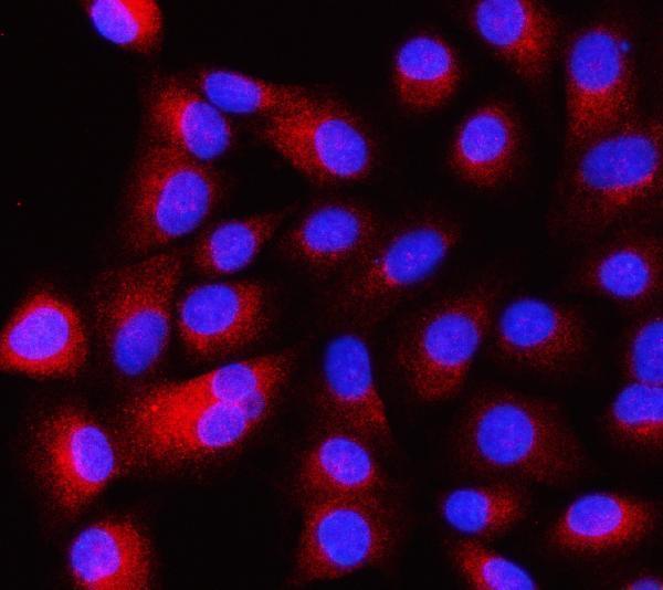 a03616 1 itsn1 primary antibodies if testing 2