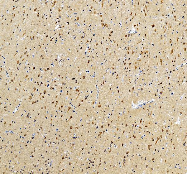 a03616 1 itsn1 primary antibodies ihc testing 1