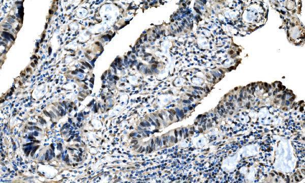  IHC analysis of DLX2 using anti-DLX2 antibody (A03617-2)