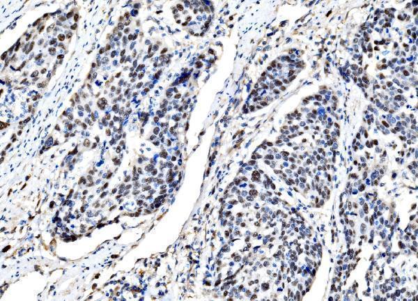 a03617 2 dlx2 primary antibodies ihc testing 3