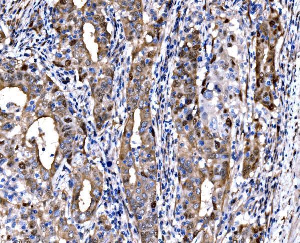 a03617 2 dlx2 primary antibodies ihc testing 4