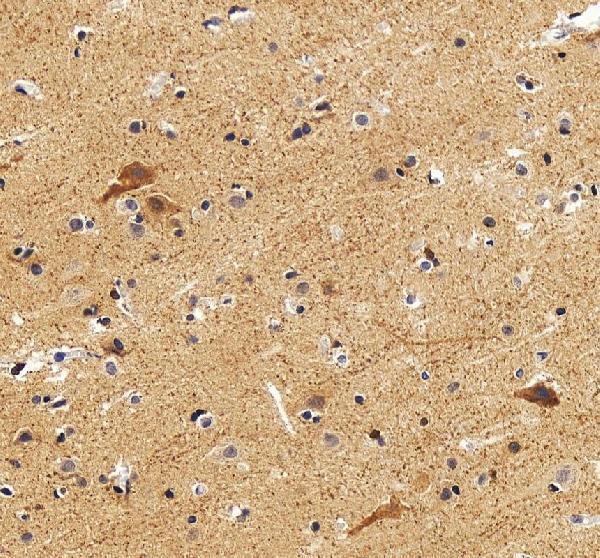IHC analysis of DLX2 using anti-DLX2 antibody (A03617-2)