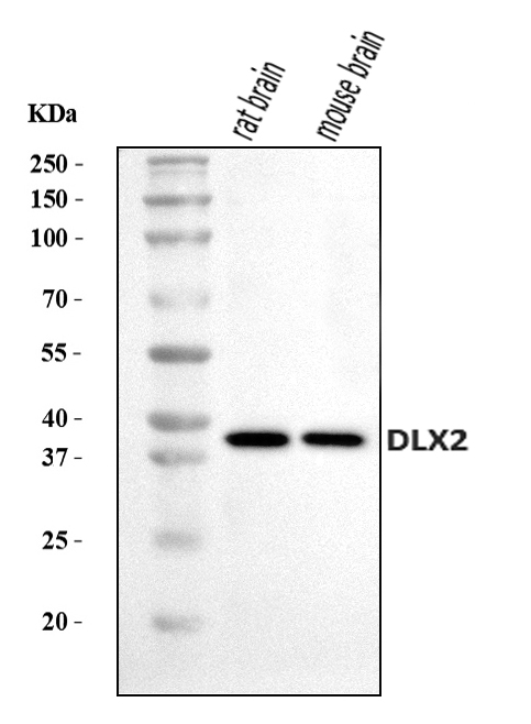  Western blot analysis of DLX2 using anti-DLX2 antibody (A03617-2)