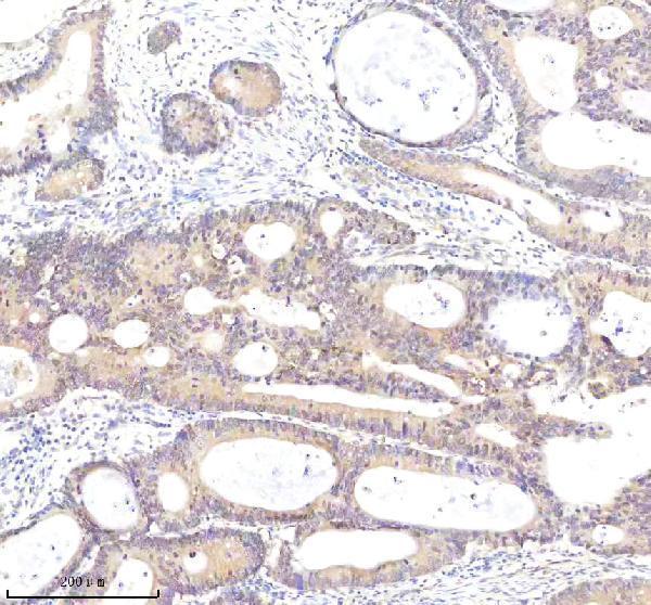  IHC analysis of HSPA4 using anti-HSPA4 antibody (A03618-2)