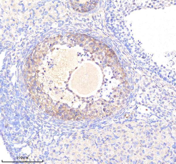 a03618 2 hspa4 primary antibodies ihc testing 4