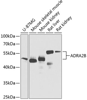 a03622 1 adra2b primary antiboties wb testing 1