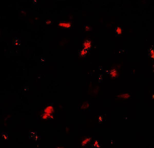 a03623 1 grk6 primary antibodies if testing 3