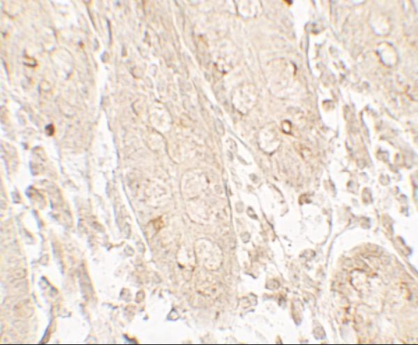 a03623 1 grk6 primary antibodies ihc testing 2