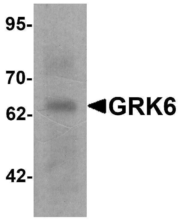 a03623 1 grk6 primary antibodies wb testing 1