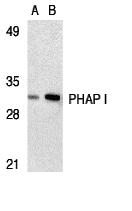Western Blot Validation in Human Raji Cell Lysate
Loading: 15 μg of lysates per lane