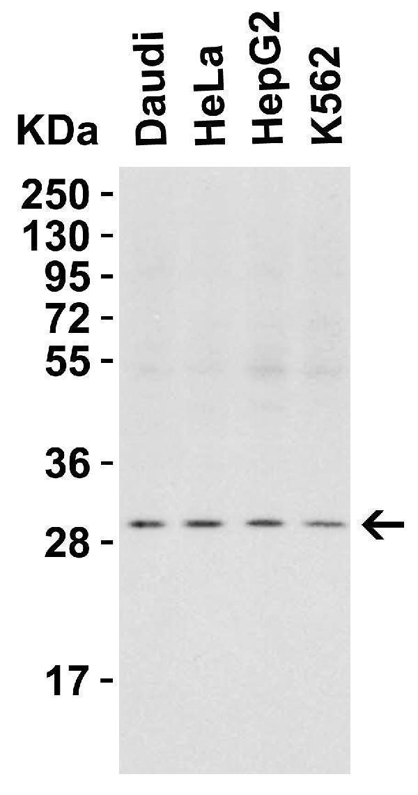 Western Blot Validation in Human Cell Lines
Loading: 15 μg of lysates per lane