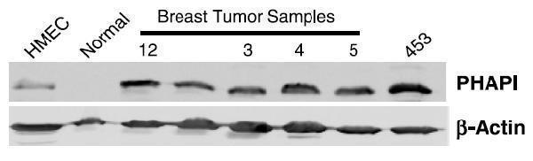 a03625 1 anp32a primary antibodies wb testing 7