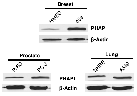 a03625 1 anp32a primary antibodies wb testing 8