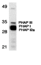 a03625 2 anp32a primary antibodies wb testing 1