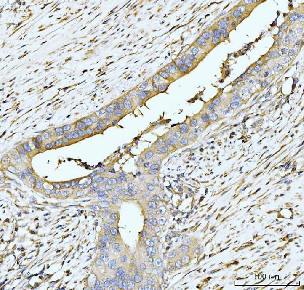  IHC analysis of HUPF2/RENT2/UPF2 using anti-HUPF2/RENT2/UPF2 antibody (A03627-2)