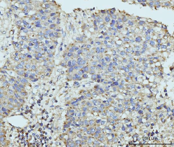  IHC analysis of HUPF2/RENT2/UPF2 using anti-HUPF2/RENT2/UPF2 antibody (A03627-2)