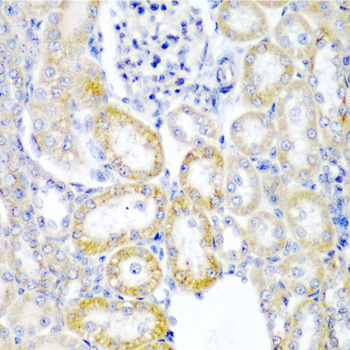 Immunohistochemistry of paraffin-embedded rat kidney using UPF2 antibody at dilution of 1:200 (40x lens)