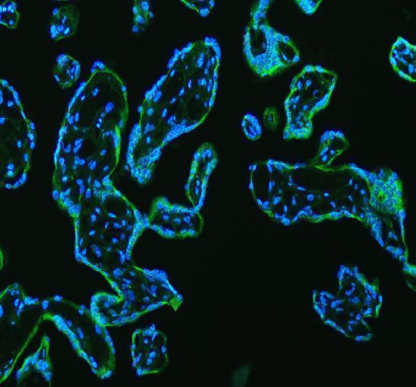 a03628 1 lman1 primary antibodies if testing 1_1