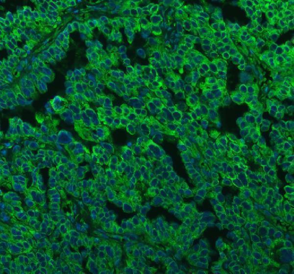 a03628 1 lman1 primary antibodies if testing 2_1