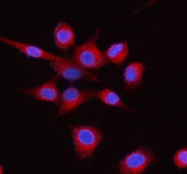 a03628 1 lman1 primary antibodies if testing 5_1