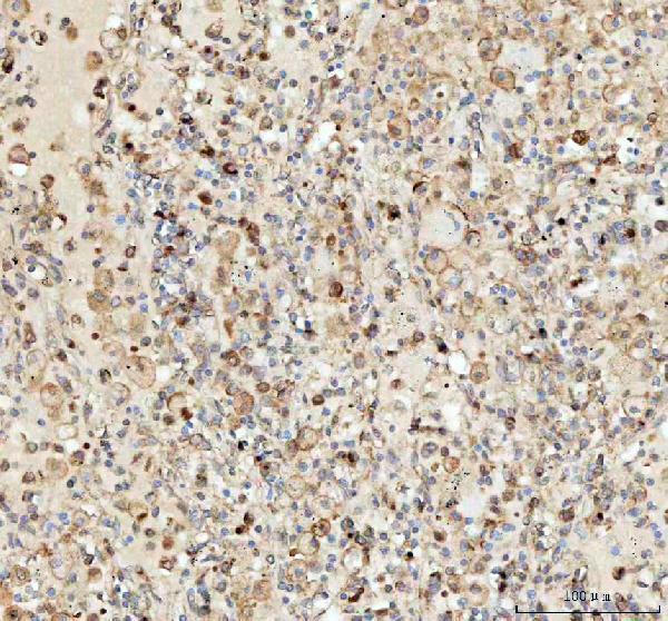 a03628 1 lman1 primary antibodies ihc testing 3_1
