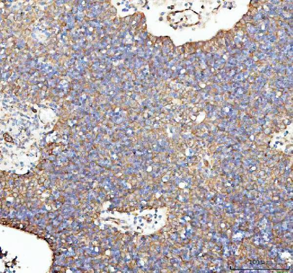 a03628 1 lman1 primary antibodies ihc testing 4_1
