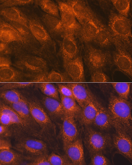 Immunofluorescence analysis of C6 cells using LMAN1 Rabbit pAb  at dilution of 1:100 
