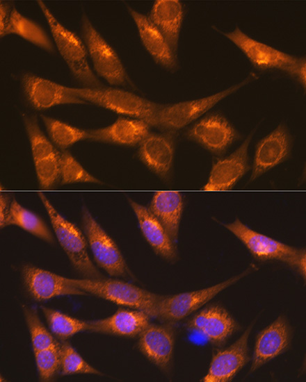 Immunofluorescence analysis of NIH-3T3 cells using LMAN1 Rabbit pAb  at dilution of 1:100 