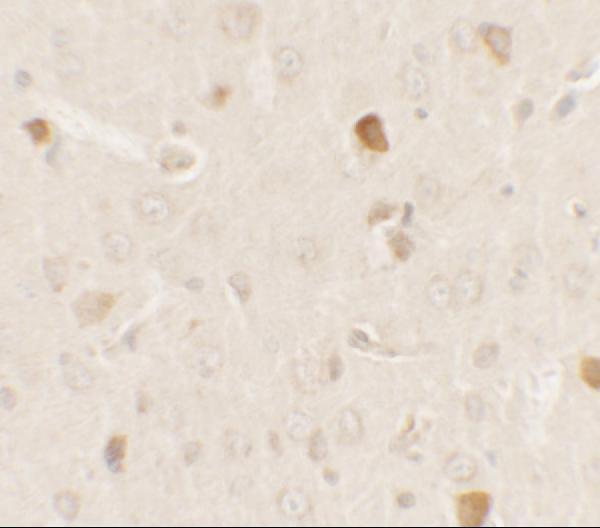 a03629 akt1s1 primary antibodies ihc testing 2