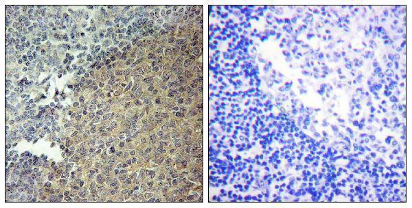 a03630 1 blnk primary antibodies ihc testing 1