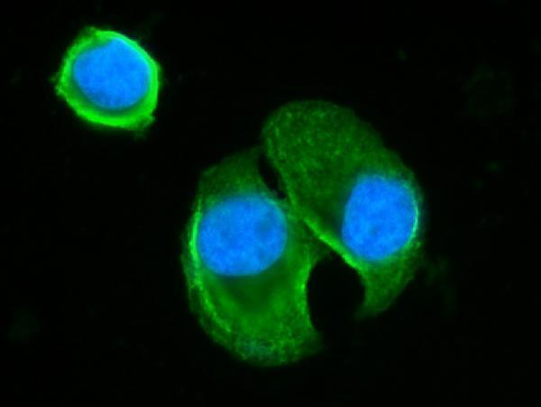  IF analysis of BLNK using anti-BLNK antibody (A03630-2)