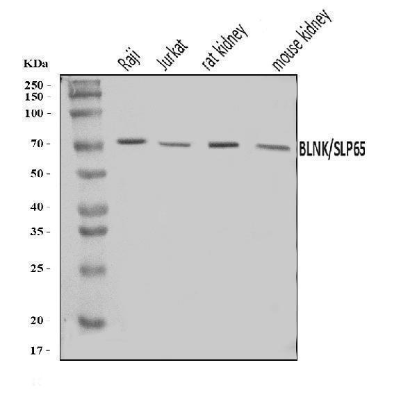  Western blot analysis of BLNK using anti-BLNK antibody (A03630-2)