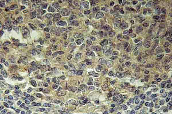 a03630 blnk primary antiboties ihc testing 2