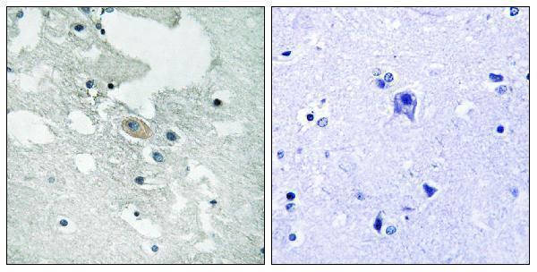 a03630y84 1 blnk primary antibodies ihc testing 1