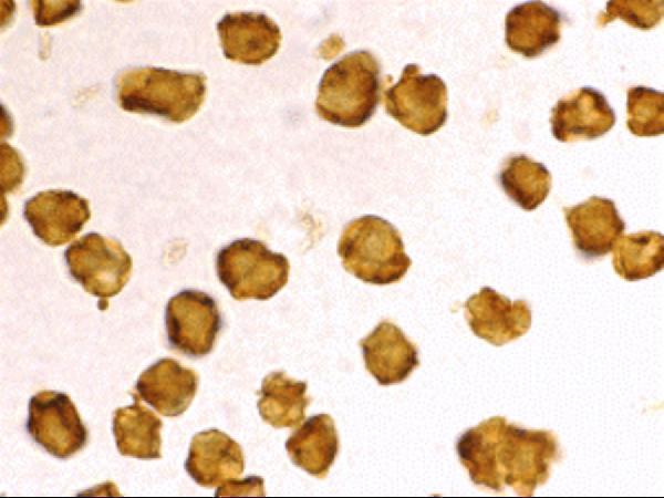 Immunocytochemistry staining of Daudi cells using SARM antibody at 2 μg/mL